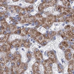 Invitrogen MCCC2 Polyclonal Antibody 100 &mu;L; Unconjugated:Antibodies,