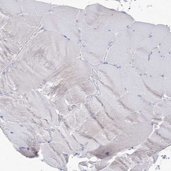 Invitrogen MCCC2 Polyclonal Antibody 100 &mu;L; Unconjugated:Antibodies,