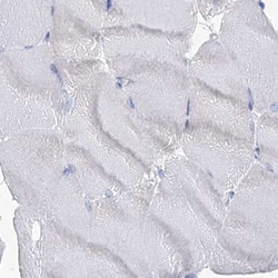 Invitrogen MCCC2 Polyclonal Antibody 100 &mu;L; Unconjugated:Antibodies,