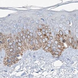 Invitrogen MCCC2 Polyclonal Antibody 100 &mu;L; Unconjugated:Antibodies,