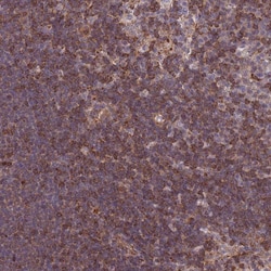 Invitrogen CDC25B Polyclonal Antibody 100 &mu;L; Unconjugated:Antibodies,