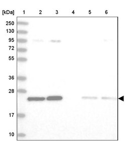 Invitrogen TPT1 Polyclonal Antibody 100 &mu;L | Buy Online | Invitrogen&trade; | Fisher Scientific