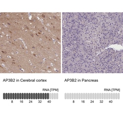 Invitrogen AP3B2 Polyclonal Antibody 100 &mu;L; Unconjugated:Antibodies,