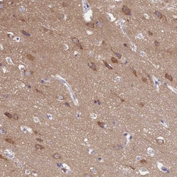 Invitrogen AP3B2 Polyclonal Antibody 100 &mu;L; Unconjugated:Antibodies,