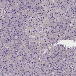 Invitrogen AP3B2 Polyclonal Antibody 100 &mu;L; Unconjugated:Antibodies,