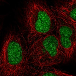 Invitrogen ORC3 Polyclonal Antibody 100 &mu;L; Unconjugated:Antibodies,