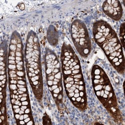 Invitrogen IL17RD Polyclonal Antibody 100 &mu;L; Unconjugated:Antibodies,