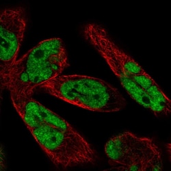Invitrogen WBP11 Polyclonal Antibody 100 μL; Unconjugated:Antibodies,