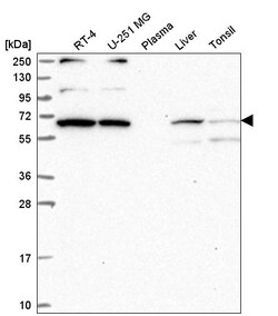 Invitrogen WBP11 Polyclonal Antibody 100 &mu;L | Buy Online | Invitrogen&trade; | Fisher Scientific
