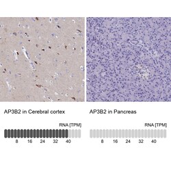 Invitrogen AP3B2 Polyclonal Antibody 100 &mu;L; Unconjugated:Antibodies,