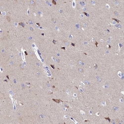 Invitrogen AP3B2 Polyclonal Antibody 100 &mu;L; Unconjugated:Antibodies,