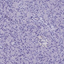Invitrogen AP3B2 Polyclonal Antibody 100 &mu;L; Unconjugated:Antibodies,