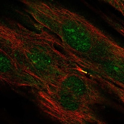 Invitrogen TMEM117 Polyclonal Antibody 100 &mu;L | Buy Online | Invitrogen&trade; | Fisher Scientific