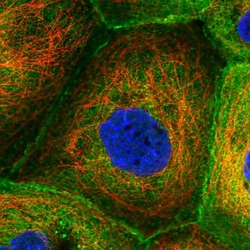 Invitrogen Coronin 1B Polyclonal Antibody 100 &mu;L; Unconjugated:Antibodies,