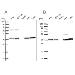 Invitrogen TALDO1 Polyclonal Antibody 100 &mu;L; Unconjugated:Antibodies,