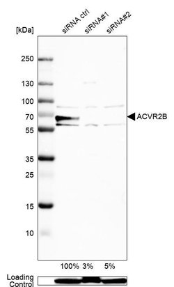 ACVR2B Polyclonal Antibody, Invitrogen 100 &mu;L | Buy Online | Invitrogen | Fisher Scientific