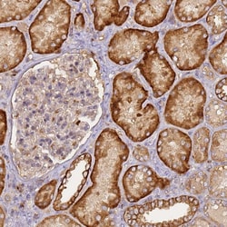 Invitrogen M6PR Polyclonal Antibody 100 &mu;L; Unconjugated:Antibodies,