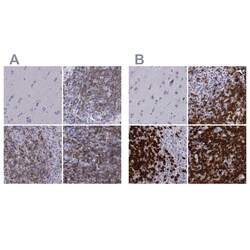 Invitrogen CD3e Polyclonal Antibody 100 &mu;L | Buy Online | Invitrogen&trade; | Fisher Scientific