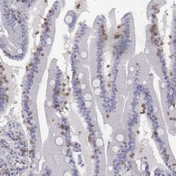 Invitrogen CD3e Polyclonal Antibody 100 μL; Unconjugated:Antibodies,