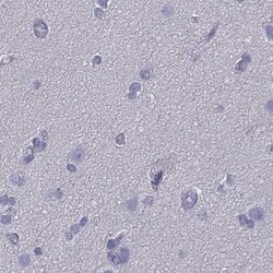 Invitrogen CD3e Polyclonal Antibody 100 μL; Unconjugated:Antibodies,