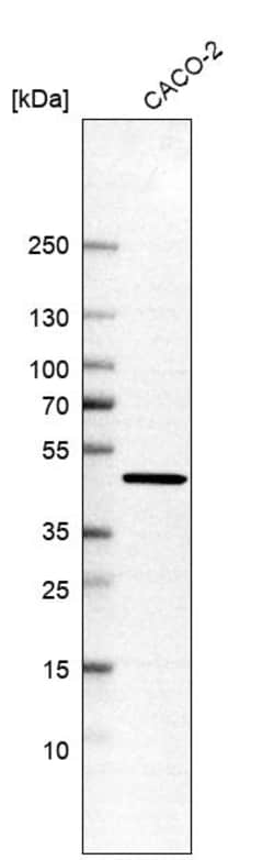 Invitrogen AHCY Polyclonal Antibody 100 &mu;L; Unconjugated:Antikörper