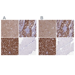 Invitrogen ABAT Polyclonal Antibody:Antibodies:Primary Antibodies
