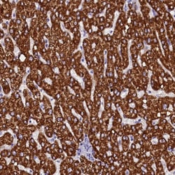 Invitrogen ABAT Polyclonal Antibody 100 &mu;L; Unconjugated:Antibodies,
