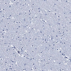 Invitrogen LYPD3 Polyclonal Antibody 100 μL; Unconjugated:Antibodies,