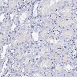 Invitrogen LYPD3 Polyclonal Antibody 100 μL; Unconjugated:Antibodies,