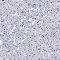Invitrogen LYPD3 Polyclonal Antibody 100 μL; Unconjugated:Antibodies,