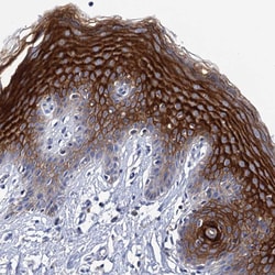 Invitrogen LYPD3 Polyclonal Antibody 100 μL; Unconjugated:Antibodies,