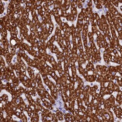 Invitrogen ABAT Polyclonal Antibody 100 &mu;L; Unconjugated:Antibodies,