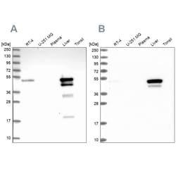Invitrogen ABAT Polyclonal Antibody 100 &mu;L; Unconjugated:Antibodies,