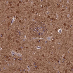 Invitrogen ACK1 Polyclonal Antibody 100 &mu;L; Unconjugated:Antibodies,
