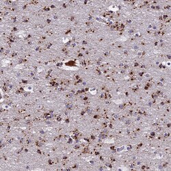Invitrogen ADAMTS13 Polyclonal Antibody 100 &mu;L; Unconjugated:Antibodies,