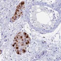 Invitrogen ADAMTS13 Polyclonal Antibody 100 &mu;L; Unconjugated:Antibodies,