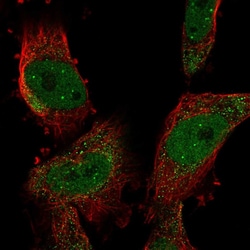 Invitrogen SUMO2 Polyclonal Antibody:Antibodies:Primary Antibodies