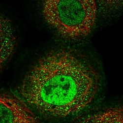 Invitrogen ARTS1 Polyclonal Antibody 100 μL; Unconjugated:Antibodies,