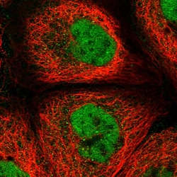 REXO1 Polyclonal Antibody:Antibodies, Polyclonal