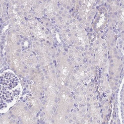 Invitrogen SFTPA1 Polyclonal Antibody 100 μL; Unconjugated:Antibodies,