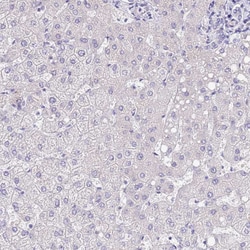 Invitrogen SFTPA1 Polyclonal Antibody 100 μL; Unconjugated:Antibodies,