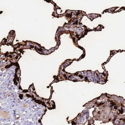 Invitrogen SFTPA1 Polyclonal Antibody 100 μL; Unconjugated:Antibodies,
