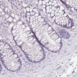 Invitrogen SFTPA1 Polyclonal Antibody 100 μL; Unconjugated:Antibodies,