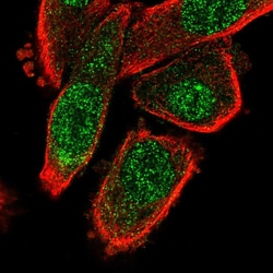 Invitrogen MED10 Polyclonal Antibody 100 &mu;L; Unconjugated:Antibodies,