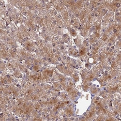 Invitrogen ADAMTS13 Polyclonal Antibody 100 μL; Unconjugated:Antibodies,