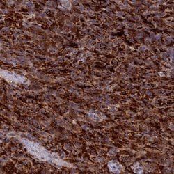 Biliverdin Reductase Polyclonal Antibody, Invitrogen 100 &mu;L; Unconjugated:Antibodies,