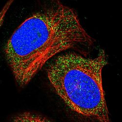 ADAMTS15 Polyclonal Antibody, Invitrogen 100 &mu;L; Unconjugated:Antibodies,