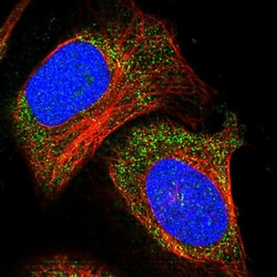 Invitrogen ADAMTS15 Polyclonal Antibody 100 &mu;L; Unconjugated:Antibodies,