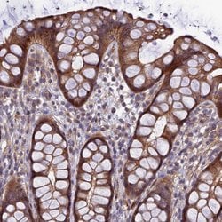 ADAMTS15 Polyclonal Antibody, Invitrogen 100 &mu;L; Unconjugated:Antibodies,