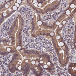 Invitrogen CYP2R1 Polyclonal Antibody 100 &mu;L; Unconjugated:Antibodies,